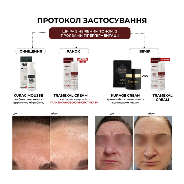 Braderm Tramexal Cream освітлюючий крем 00-00000388 фото