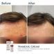 Braderm Tramexal Cream освітлюючий крем 00-00000388 фото 3